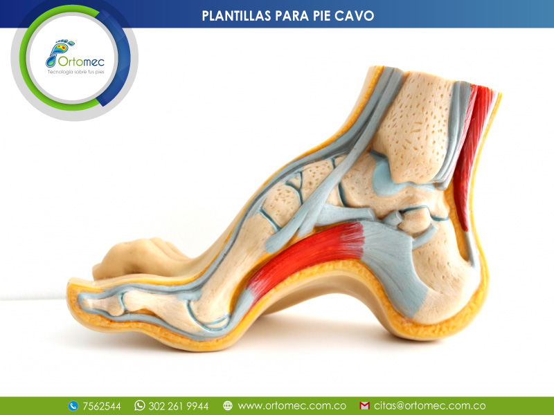 Plantillas para ortopedicas para pie Cavo