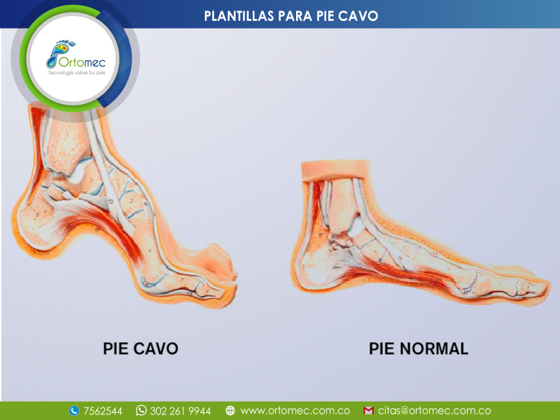 Plantillas para pie Cavo