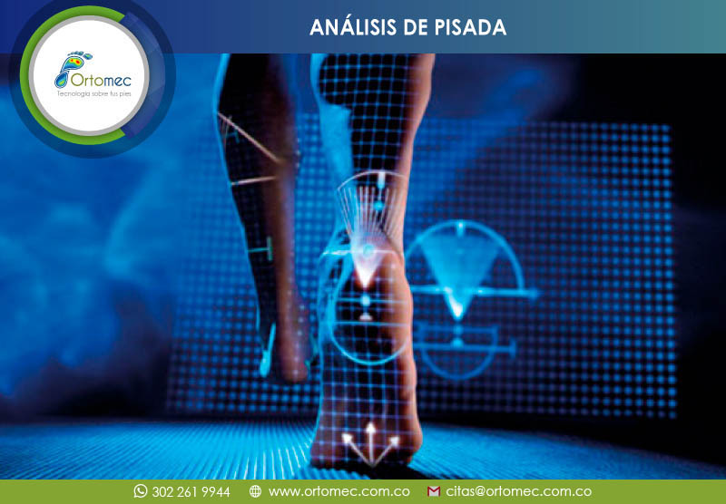 Plantillas para Análisis de la pisada