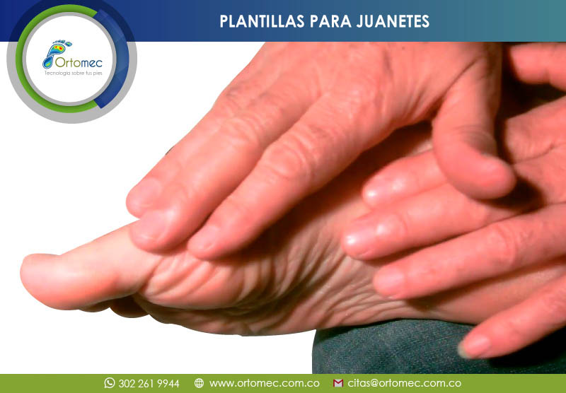 Plantillas para tratamiento Allux Valgus en bogotá
