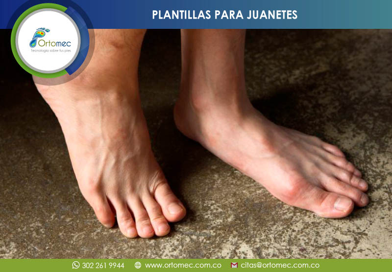 Plantillas para ortopedicas Allux Valgus